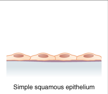 Simple Sqamous